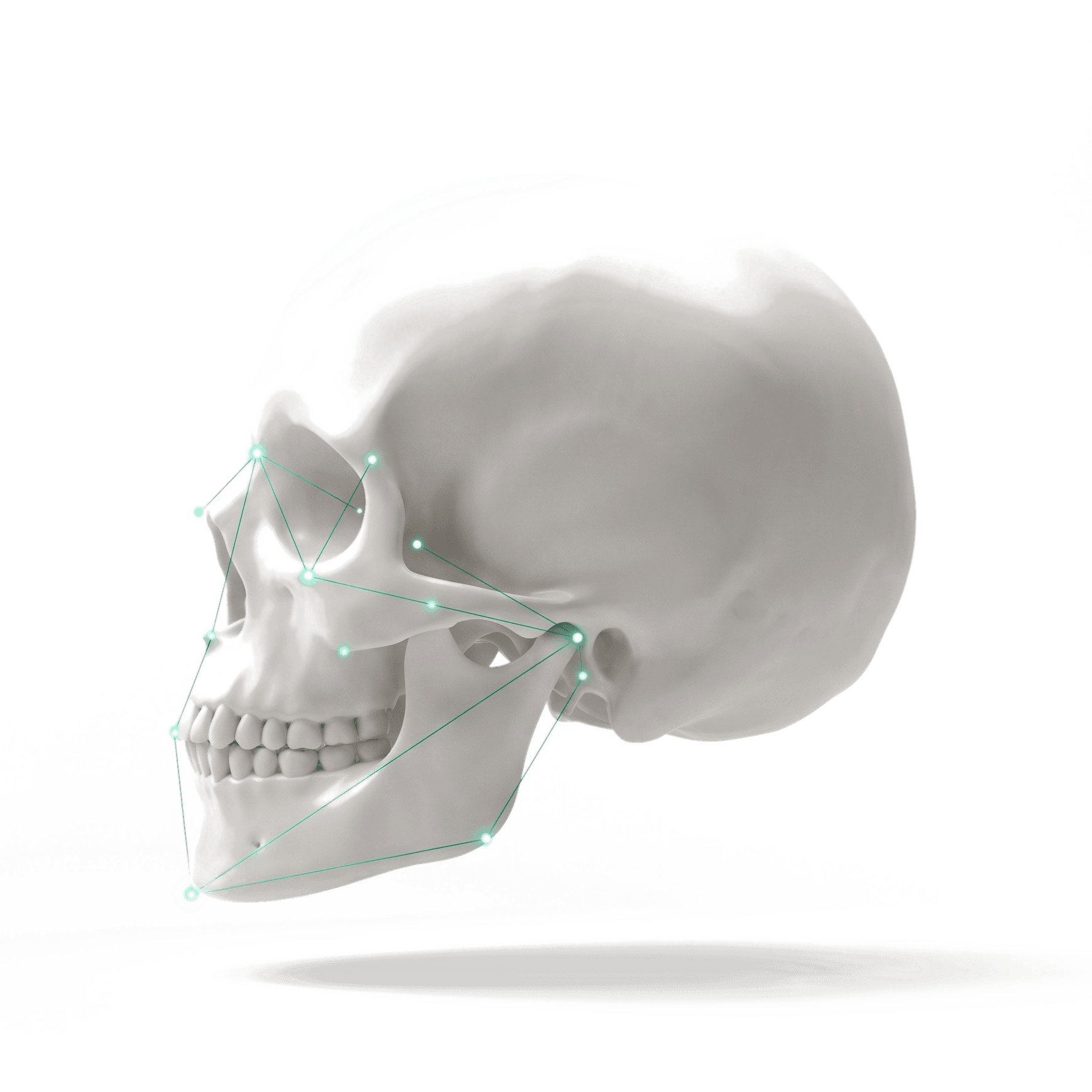 Modelo craneal 3D con puntos y trazados de referencia cefalométrica